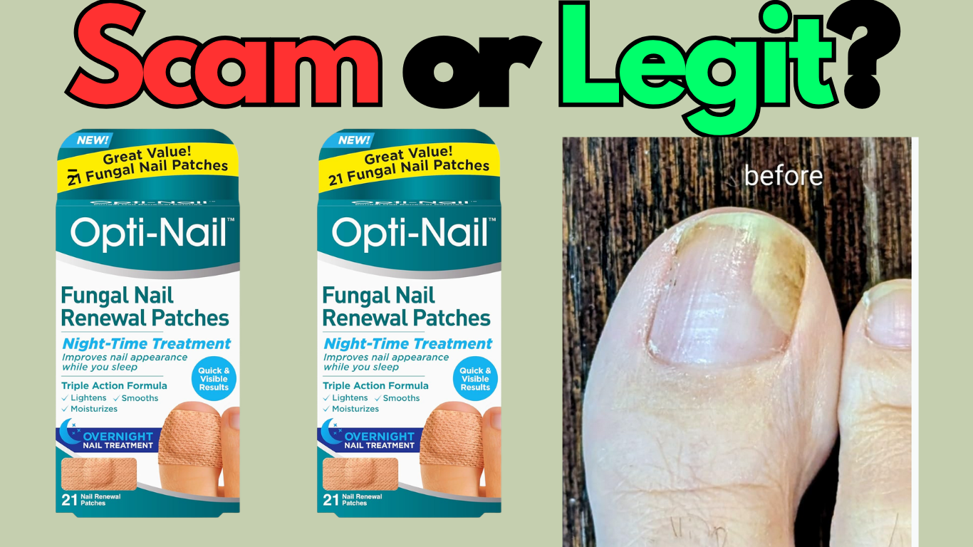 Opti-Nail Fungal Nail Renewal Patches Review 2026: Scam or Legit?